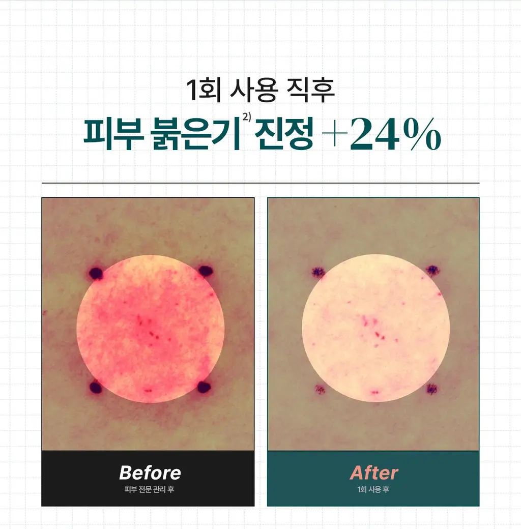 [전문 드레싱 관리_거즈 마스크]리쥬덱스 더마 리페어링 드레싱 마스크 1매 상세페이지 11